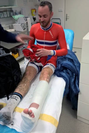 GIPSET: Morten Vaeng fikk gips på den skadde ankelen etter VM-krasjen. Foto: Norges Cyckleforbund.