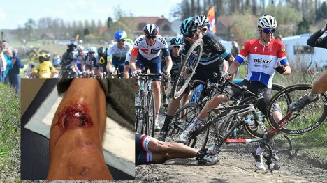 KUTTET STYGT: Fran Ventoso ble kuttet stygt av en skivebrems under Paris-Roubaix. Bildet er fra en urelatert velt i samme ritt. FOTO: Tim de Waele (TDWSport.com)/skjermdump fra Fran Ventosos facebook-side.