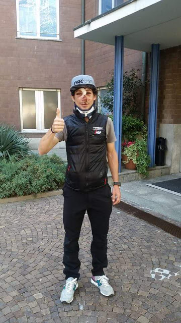 UTSKREVET: Fabio Felline ser ut som han har gått én runde mot Conor McGregor etter at han landet i asfalten med ansiktet først under Amstel Gold Race. FOTO: Fabio Fellines Facebook-konto