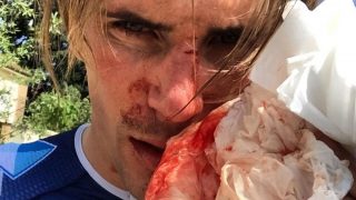 ANGREPET: Yoann Offredo var ute på treningstur da han ble angrepet. Nå hevder angriperen at Offredo var den som først ble aggressiv. Foto:  Facebook.com/Yoann Offredo