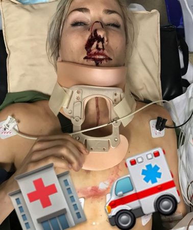 I BILULYKKE: Caroline Buchanan fikk punktert lunge etter en bilulykke ved årsskiftet. Foto: AFP PHOTO / CARL DE SOUZA