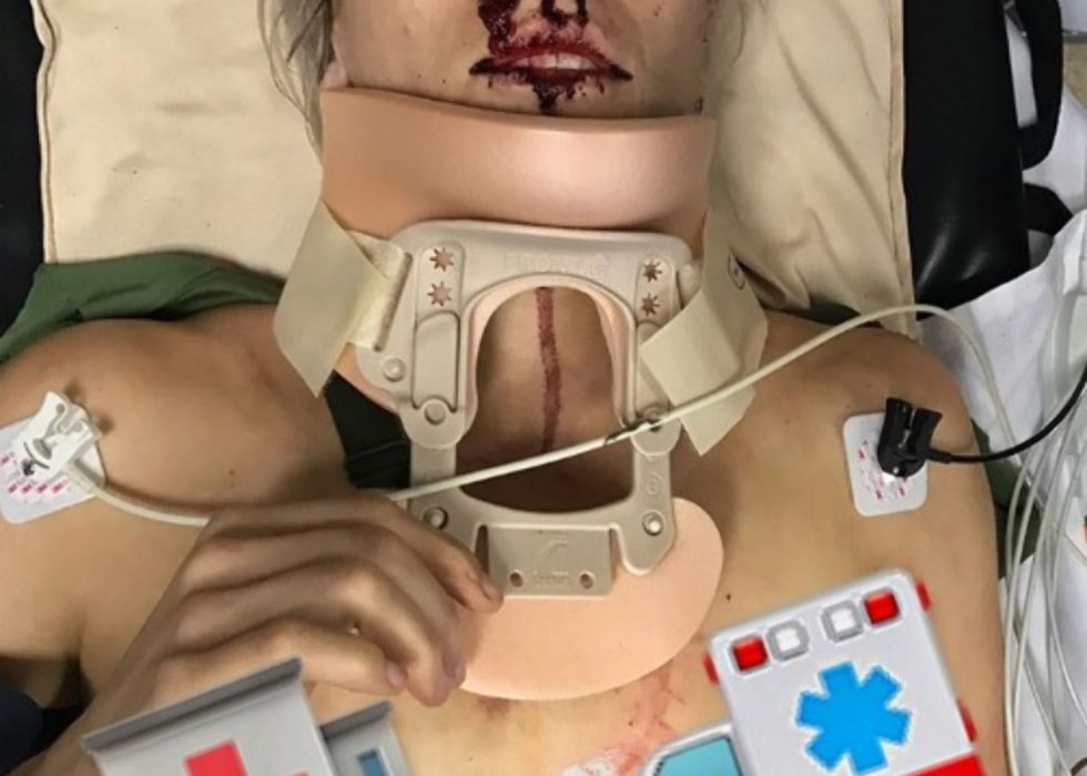 I BILULYKKE: Caroline Buchanan fikk punktert lunge etter en bilulykke ved årsskiftet. Foto: AFP PHOTO / CARL DE SOUZA