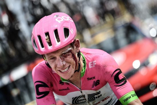 RAUS: Lawson Craddock syklet 100 kilometer med et blod kutt over øyet og en forslått og skadd skulder. Nå gir han 100 dollar til flomskadd velodrom for hver etappe han fullfører i Tour de France. FOTO: AFP/Jeff Pachound