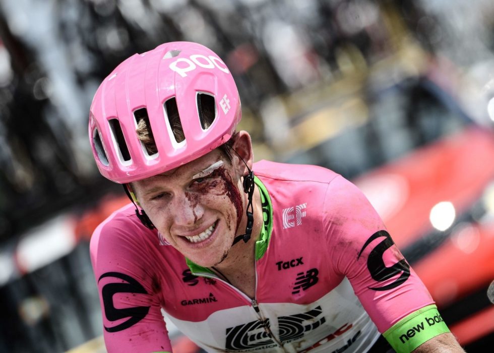 RAUS: Lawson Craddock syklet 100 kilometer med et blod kutt over øyet og en forslått og skadd skulder. Nå gir han 100 dollar til flomskadd velodrom for hver etappe han fullfører i Tour de France. FOTO: AFP/Jeff Pachound